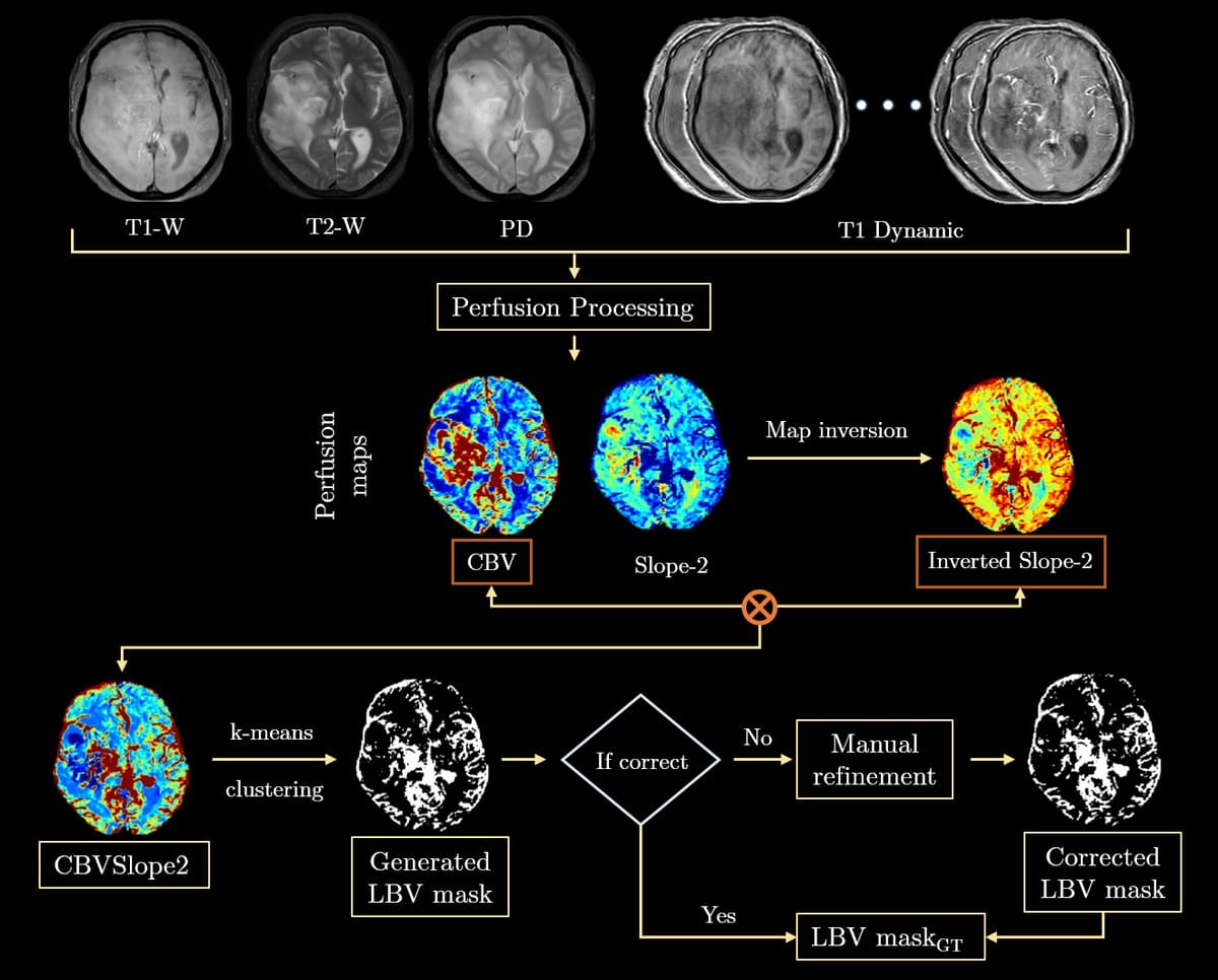 DCE-MRI vessel segmentation pipeline